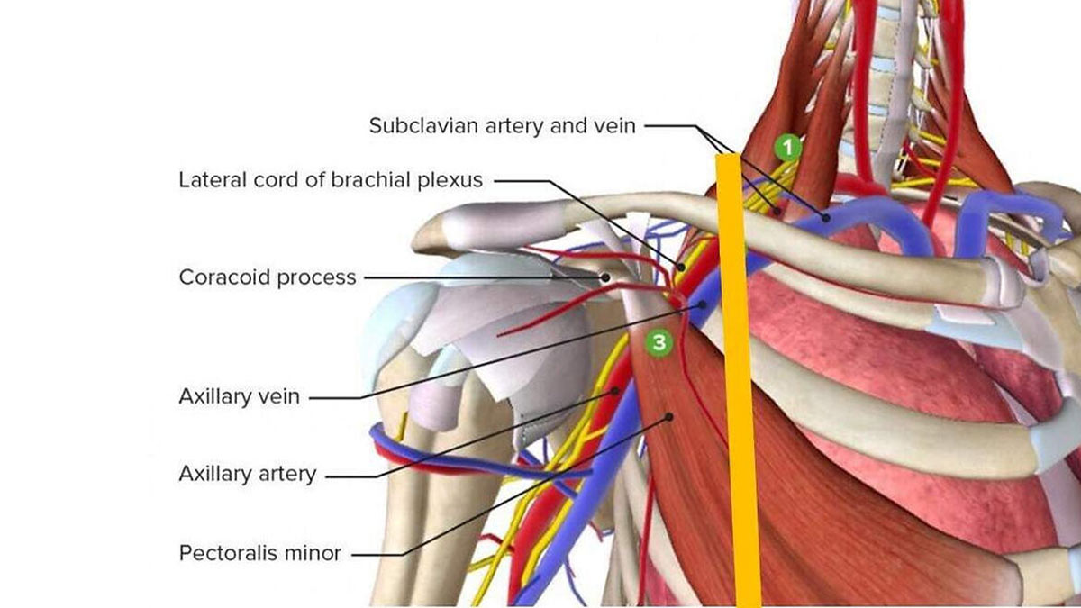 درک مکانیسم درد کمر و شانه مرتبط با ساختار سینه